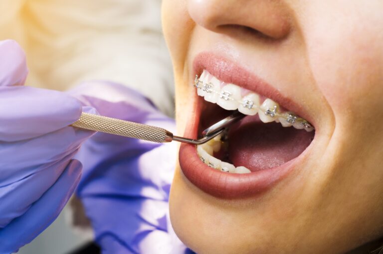 Orthodontics and Dental Health: Preventing Problems for a Lifetime of Smiles